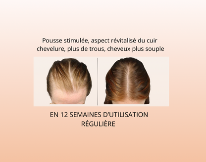 RootBoost Pro 3 EN 1 MASSEUR DE CUIR CHEVELU POUR LA CROISSANCE DES CHEVEUX